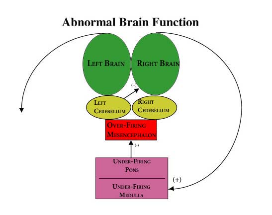 BBT Abnormal Brain
