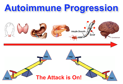 Autoimmue Progression resized 600
