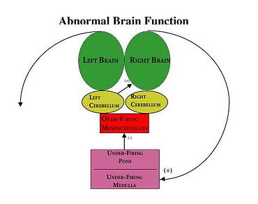 Abnormal Brain Function | Johnson Brain-Based Therapy