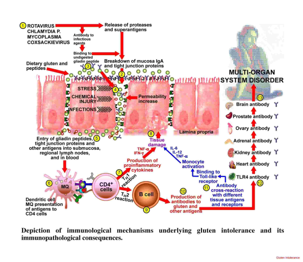 Leaky Gut and Autoimmune Disorders