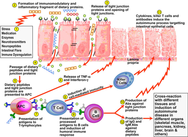 Gluten Can Trigger Autoimmune Attack