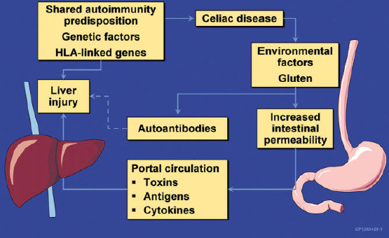 Proposed Mechanism of Liver Injury With CD resized 600