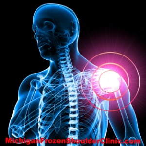 Brain-Body Miscommunication and The Frozen Shoulder Connection