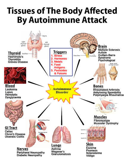 Tissues Affected By Autoimmune Attack