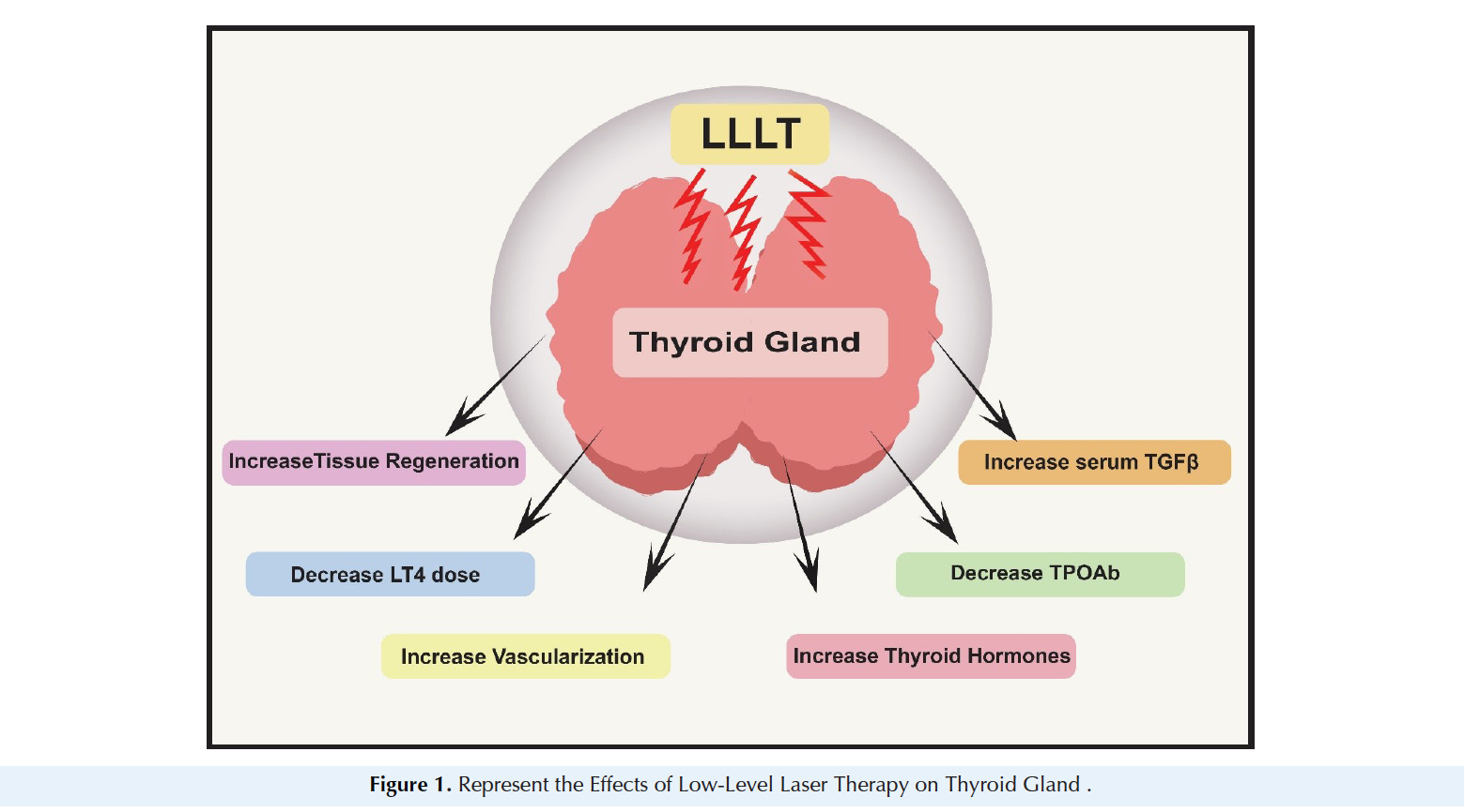 Low-Level Laser Therapy in the Treatment of Autoimmune Thyroiditis_Figure 1
