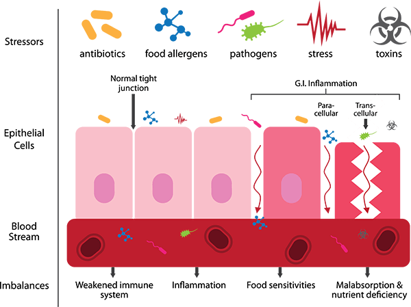 blog-leaky-gut