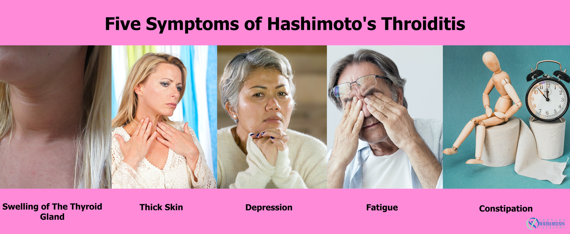 5 Symptoms of Hashimotos Thyroiditis-2000
