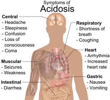 512px-Symptoms_of_acidosis
