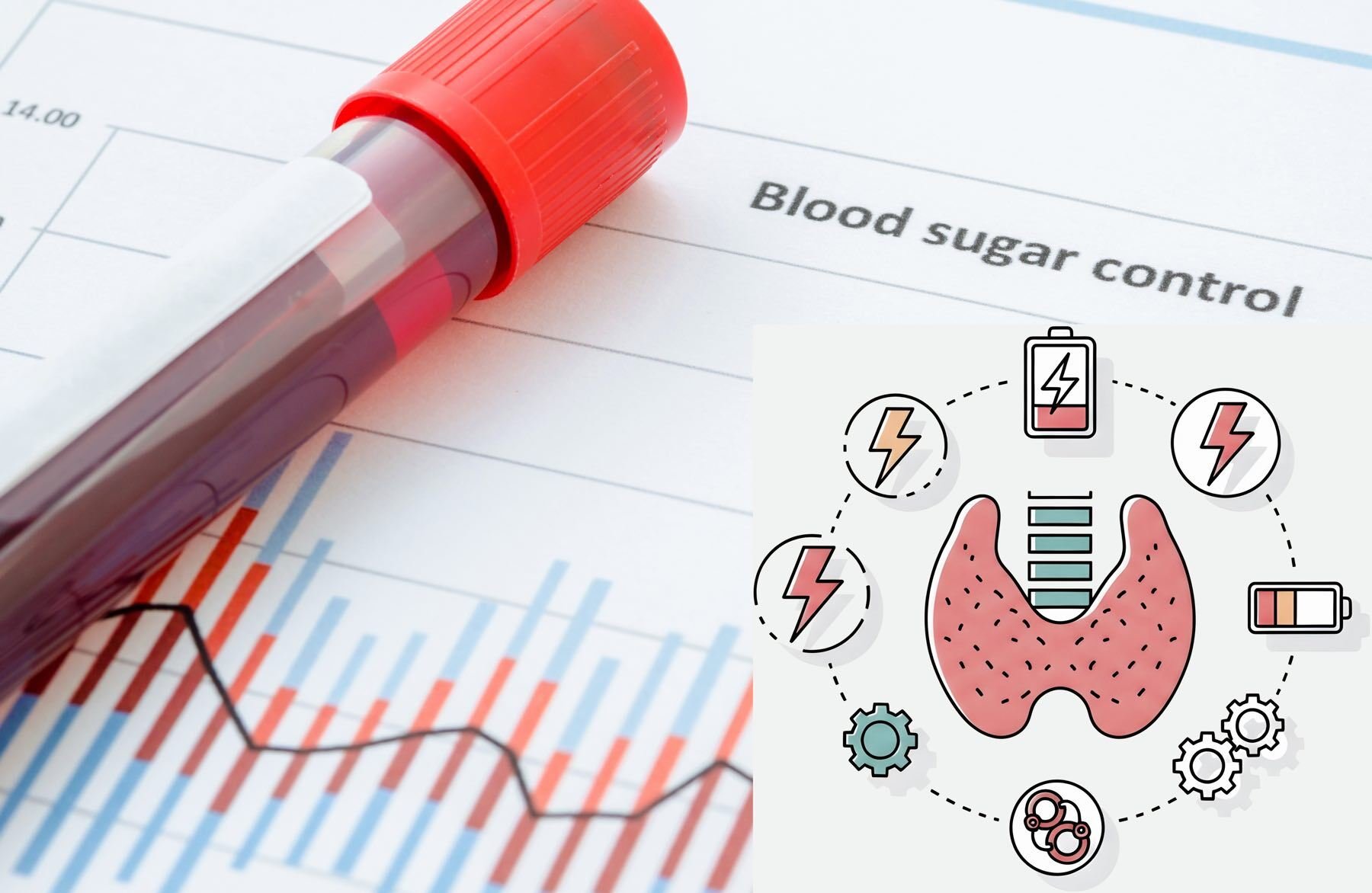 AdobeStock_Blood Sugar Instability+Hypothyroid Symptoms-1800-1