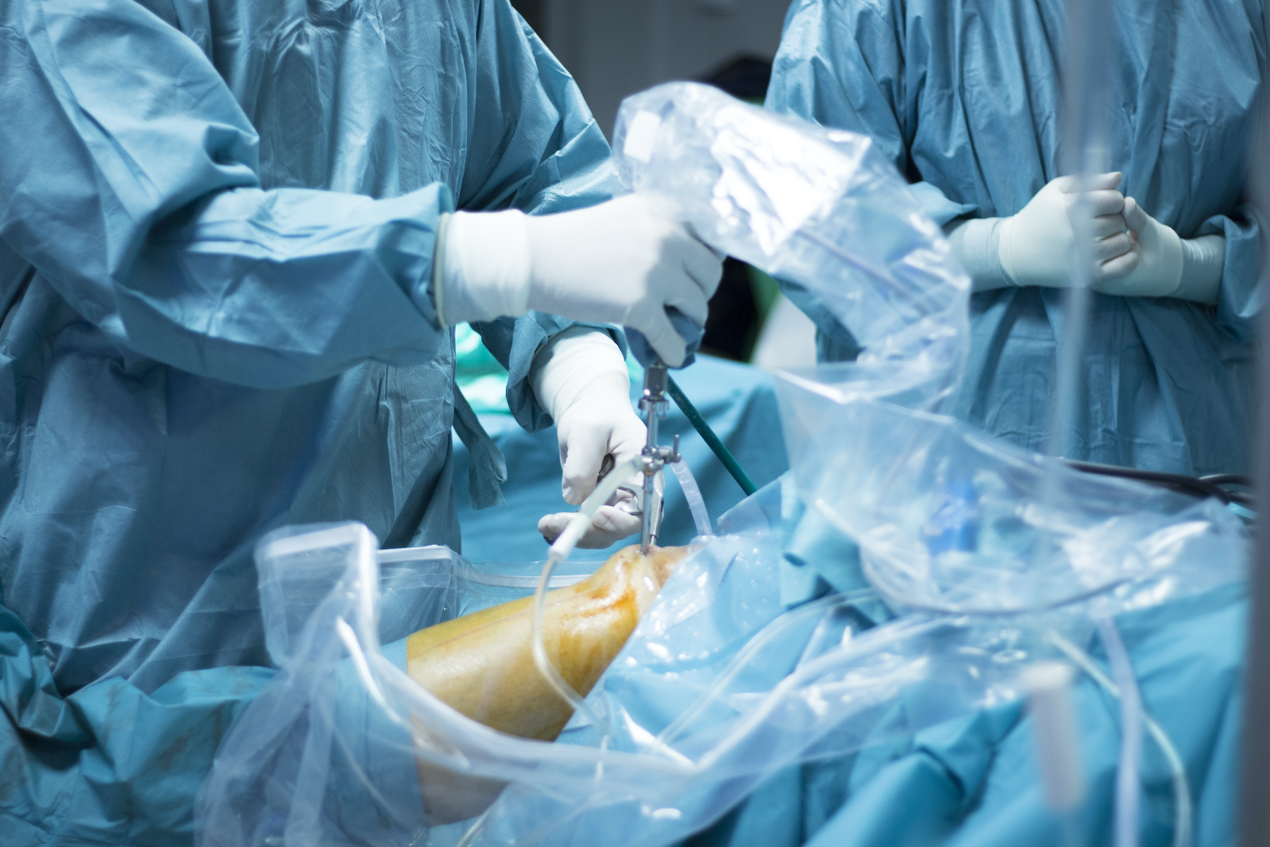 AdobeStock_Knee_Arthroscopic_Surgery-1800