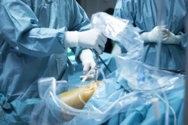 AdobeStock_Knee_Arthroscopic_Surgery-270.jpeg