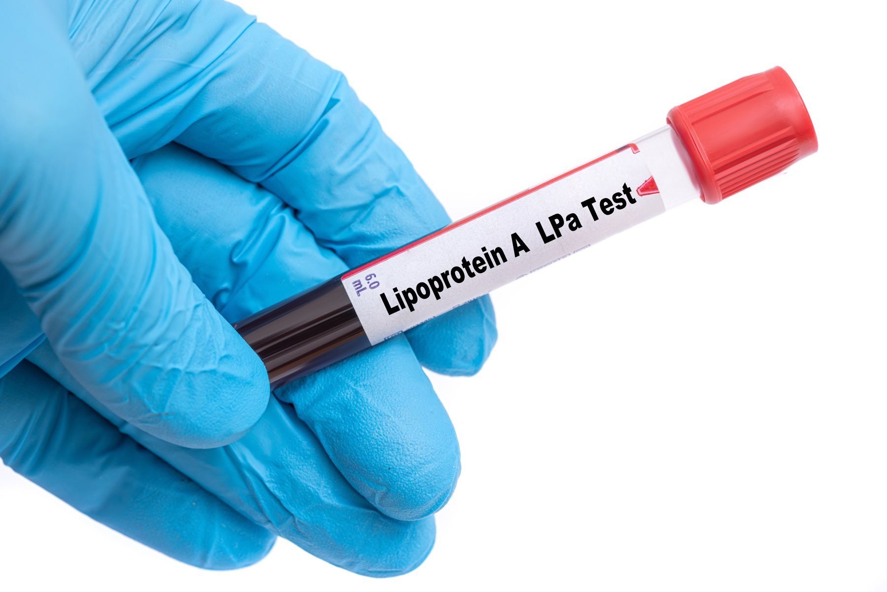 AdobeStock_Lipoprotein A LPa Test-1800