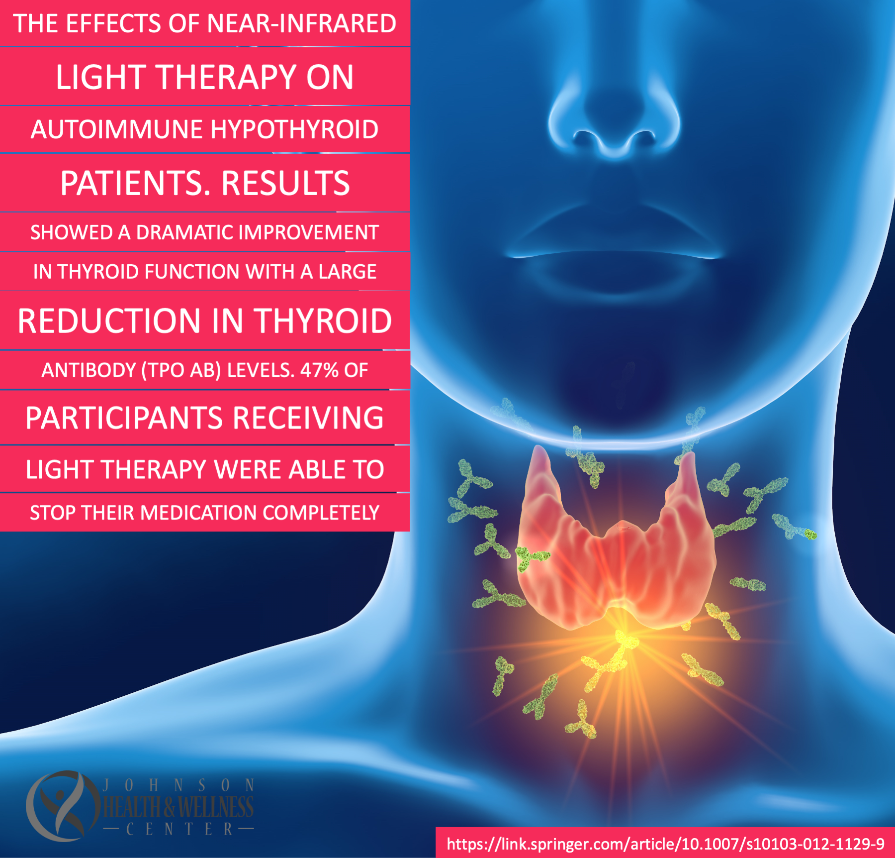Effects of Near Infrared Light on AI Thyroid
