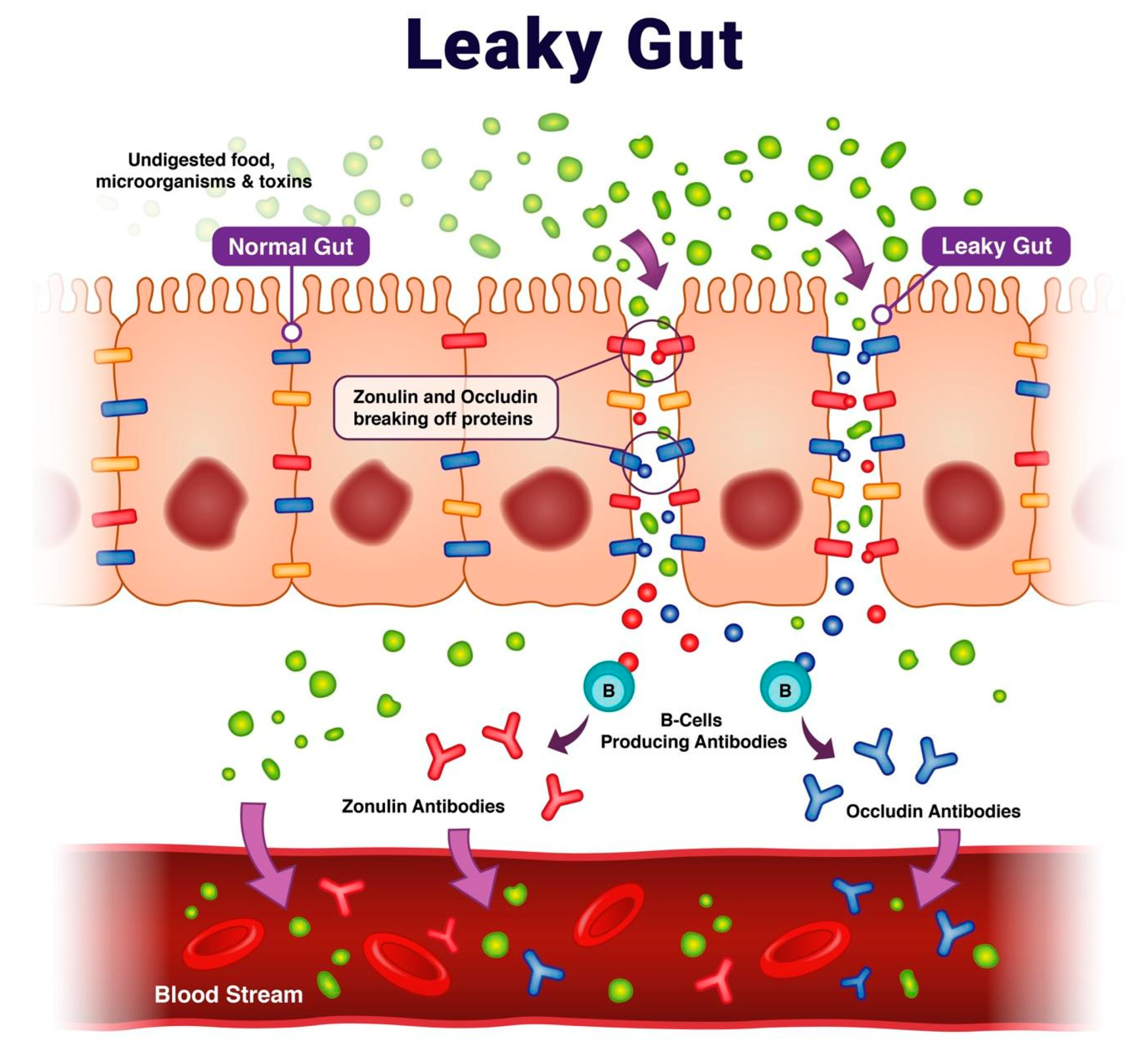 Leaky Gut Image_ijms-24-16352-g001