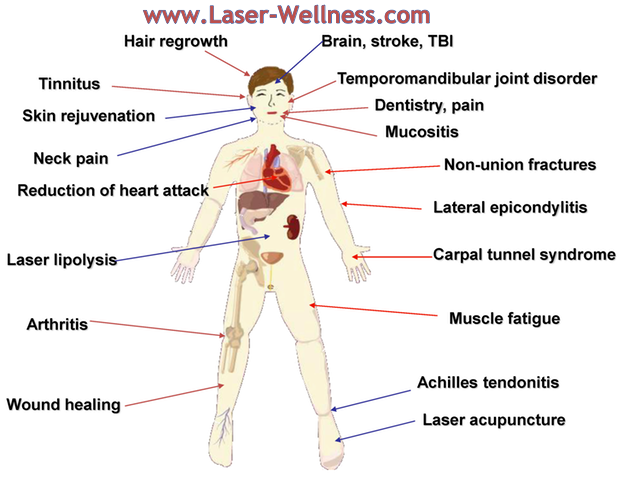 Researched_Effects_of_LASER-PhotoBioModulation-640.png