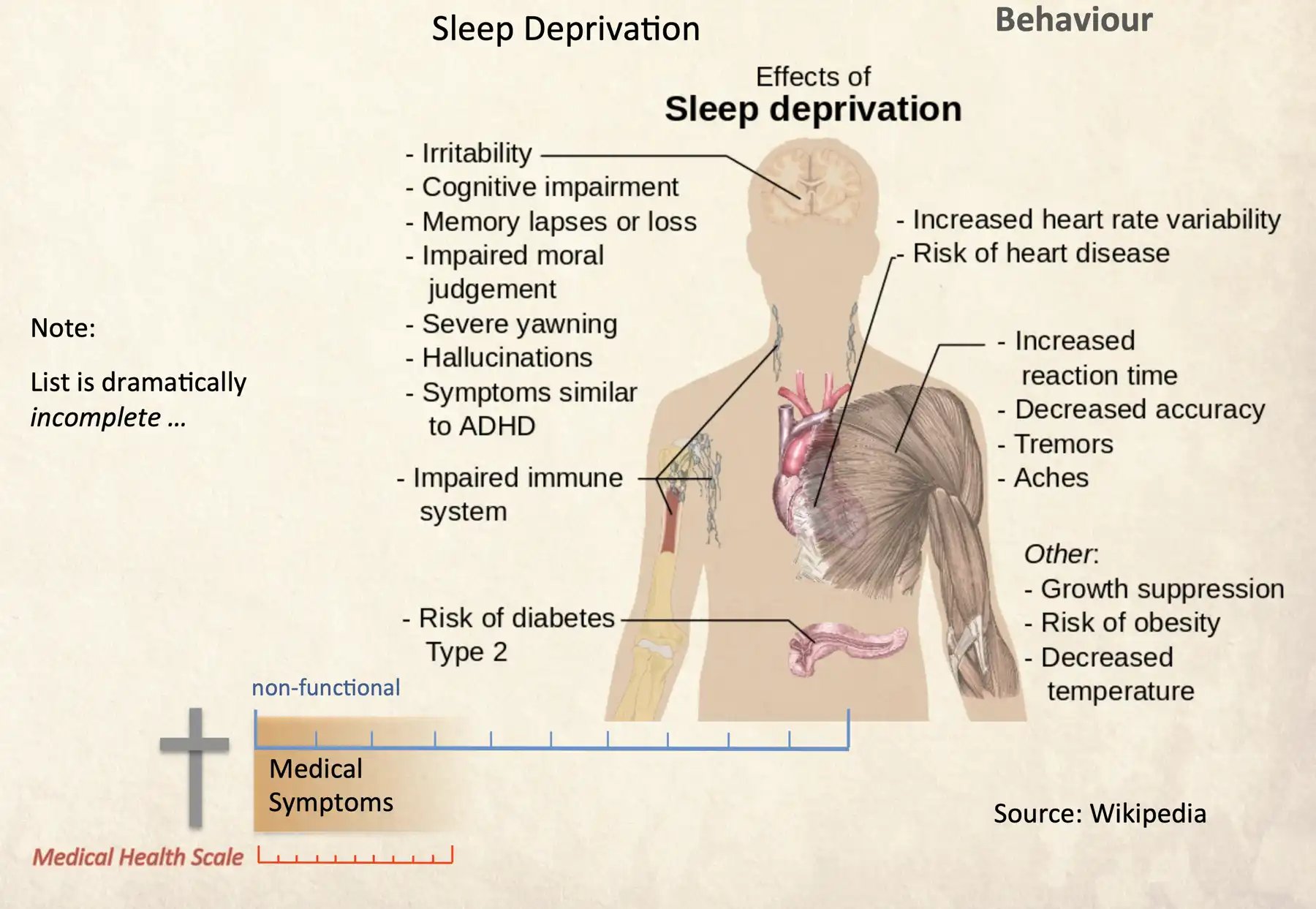 Sleep Deprivation-1800